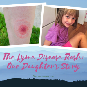 The Lyme Disease Rash: Our Daughter's Story