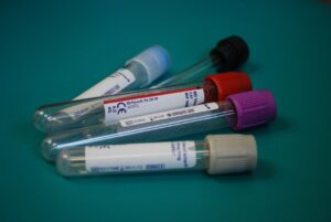 Which Lyme Tests Should You Ask Your Doctor to Order?